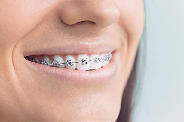 Trusted Coto De Caza, CA Dental Services Experts